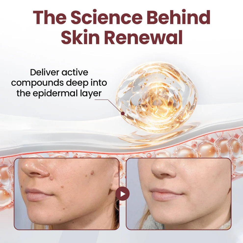 KeraErase® Dual-Action Renewal Cream( Buy 1 Get 1 Free)
