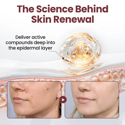 KeraErase® Dual-Action Renewal Cream( Buy 1 Get 1 Free)